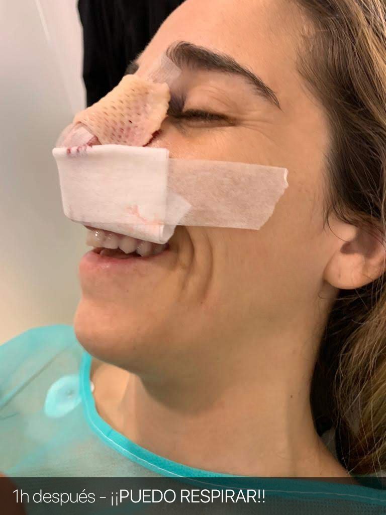 Cuanto cuesta una cirugia de septoplastia